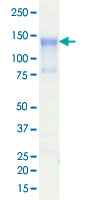 Loading 1 &mu;g protein in SDS-PAGE